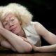 Article : Lorsque être albinos devient une revanche